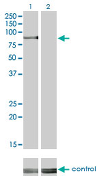 RPS6KA2 monoclonal antibody (M01), clone 1F6