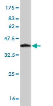 RPS6KA2 monoclonal antibody (M01), clone 1F6