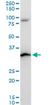 RPS3A polyclonal antibody (A01)
