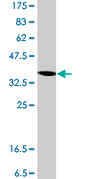 RPS3A polyclonal antibody (A01)