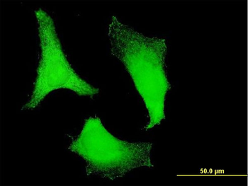 RPS2 monoclonal antibody (M01), clone 3G6