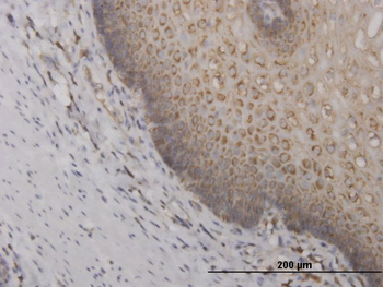 RPS2 monoclonal antibody (M01), clone 3G6