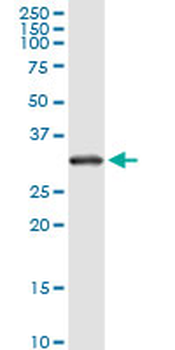 RPS2 monoclonal antibody (M01), clone 3G6