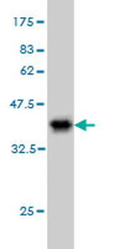 RPS2 monoclonal antibody (M01), clone 3G6