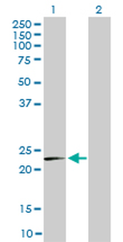 MRPL12 monoclonal antibody (M01), clone 3B12-1A3