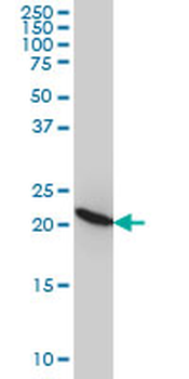 RPL9 monoclonal antibody (M01), clone 2F11