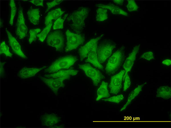 RPL4 monoclonal antibody (M01), clone 4A3