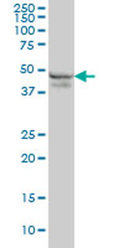 RPL4 monoclonal antibody (M01), clone 4A3