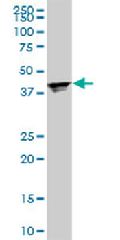 RPL4 monoclonal antibody (M01), clone 4A3
