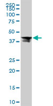 RPL4 monoclonal antibody (M01), clone 4A3
