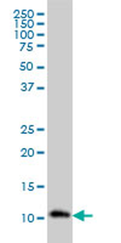RPA3 monoclonal antibody (M01), clone 1F4