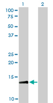 RPA3 monoclonal antibody (M01), clone 1F4