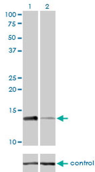 RPA3 monoclonal antibody (M01), clone 1F4