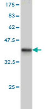 RPA3 monoclonal antibody (M01), clone 1F4