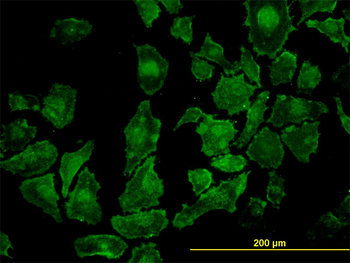 ROCK1 monoclonal antibody (M01), clone 2E2