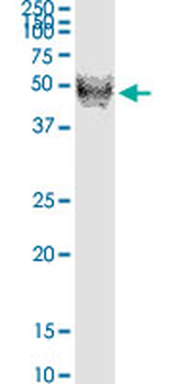 RNH1 monoclonal antibody (M07), clone 3F5