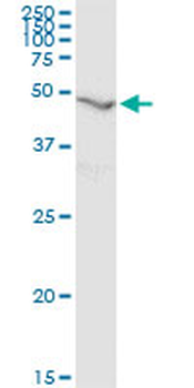 RNH1 monoclonal antibody (M07), clone 3F5