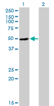 RNH1 monoclonal antibody (M07), clone 3F5