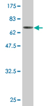 RNH1 monoclonal antibody (M07), clone 3F5