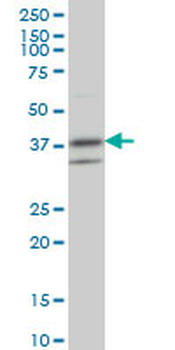 RNF2 monoclonal antibody (M01), clone 6C2
