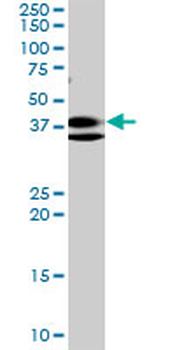 RNF2 monoclonal antibody (M01), clone 6C2