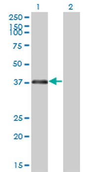 RNF2 monoclonal antibody (M01), clone 6C2