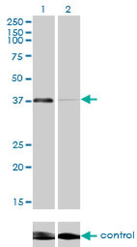 RNF2 monoclonal antibody (M01), clone 6C2