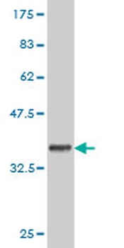 RNF2 monoclonal antibody (M01), clone 6C2
