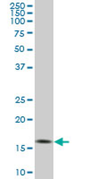 RHEB monoclonal antibody (M01), clone 2C11