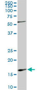 RHEB monoclonal antibody (M01), clone 2C11