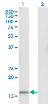 RGS13 monoclonal antibody (M06), clone 1B3