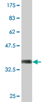 RGS13 monoclonal antibody (M06), clone 1B3