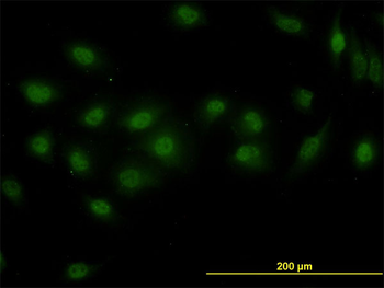 DPF2 monoclonal antibody (M01), clone 2F6