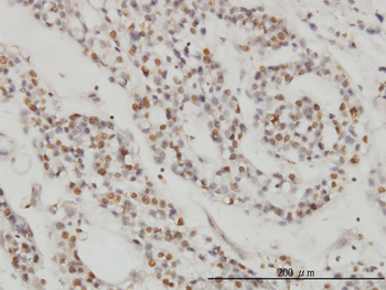 DPF2 monoclonal antibody (M01), clone 2F6