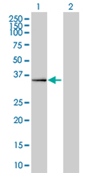 DPF2 monoclonal antibody (M01), clone 2F6