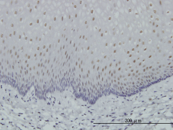 RARA monoclonal antibody (M03), clone 2D2