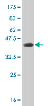 RARA monoclonal antibody (M03), clone 2D2