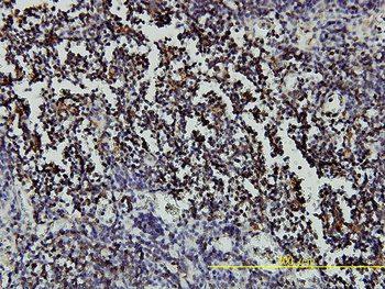 RARA monoclonal antibody (M01), clone 2C9-1F8