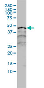 RARA monoclonal antibody (M01), clone 2C9-1F8
