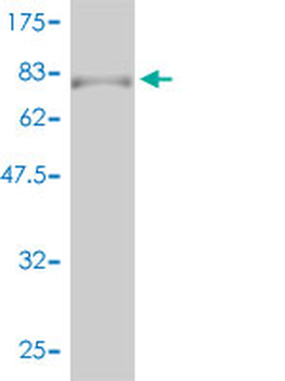 RARA monoclonal antibody (M01), clone 2C9-1F8