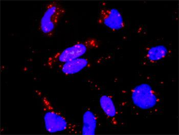 RAP1A monoclonal antibody (M01), clone 3E1