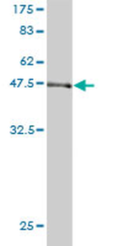 RAP1A monoclonal antibody (M01), clone 3E1