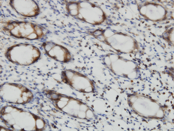 RALB monoclonal antibody (M04), clone 4D1
