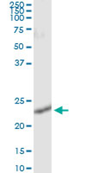 RALB monoclonal antibody (M04), clone 4D1