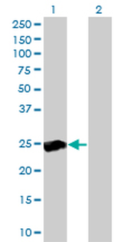 RALB monoclonal antibody (M04), clone 4D1