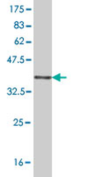 RALB monoclonal antibody (M04), clone 4D1