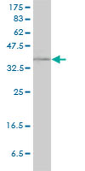 RAD51C monoclonal antibody (M01), clone 3F3-5C6