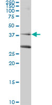 RAD51C monoclonal antibody (M01), clone 3F3-5C6