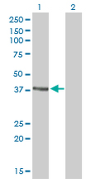 RAD51C monoclonal antibody (M01), clone 3F3-5C6