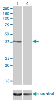 RAD51C monoclonal antibody (M01), clone 3F3-5C6